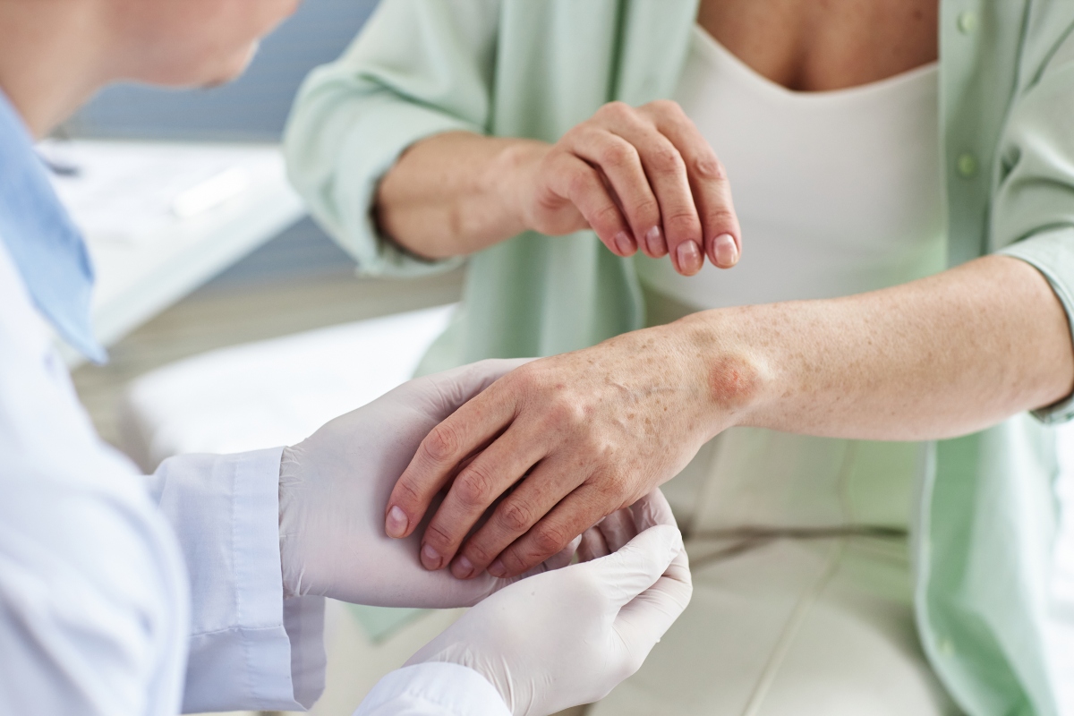 What Makes Ayurveda an Effective Treatment for Psoriasis?